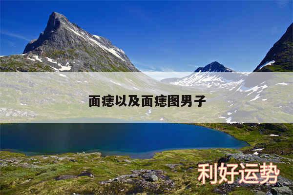 面痣以及面痣图男子