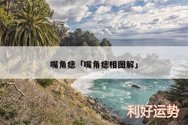 嘴角痣及嘴角痣相图解