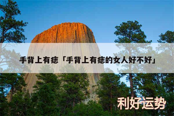 手背上有痣及手背上有痣的女人好不好
