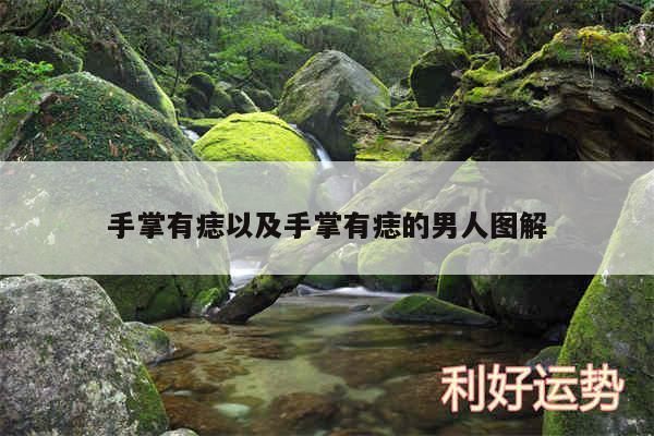 手掌有痣以及手掌有痣的男人图解